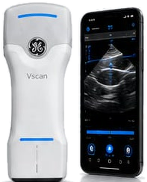Ultraschallgerät Vscan Air mit Smartphone