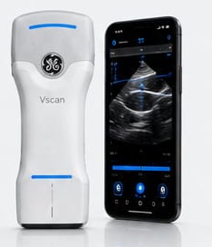 Ultraschallgerät Vscan Air mit Smartphone